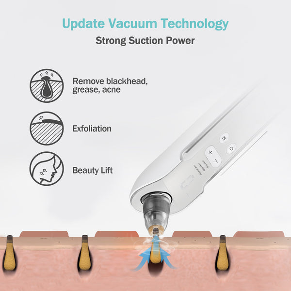 Blackhead Remover KD803A (White)